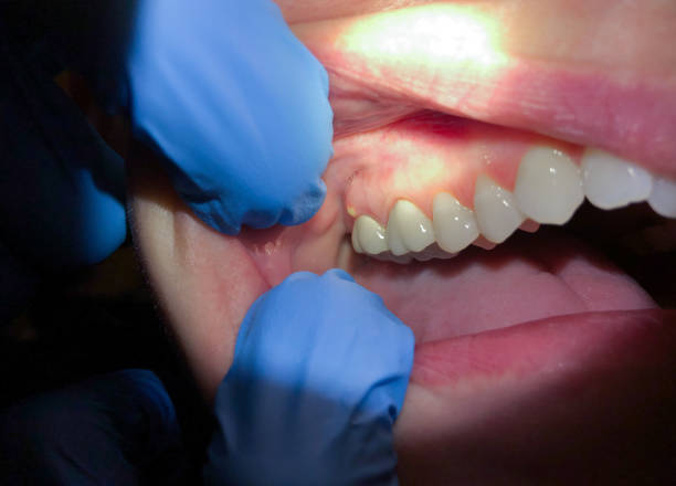 Best Dentist for Severe Toothache  in Heidelberg, PA