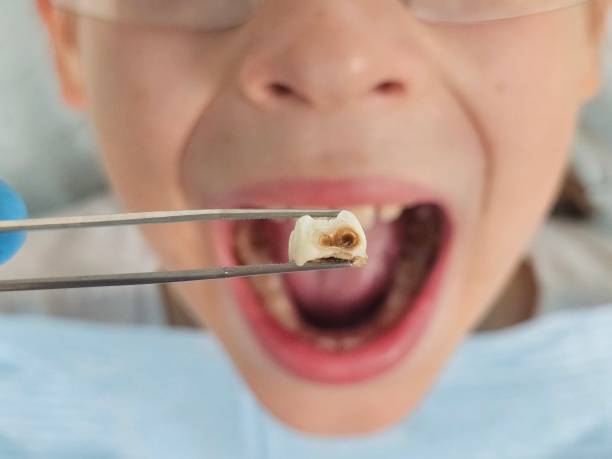 Best Knocked-Out Tooth Emergency  in Heidelberg, PA